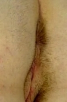 soft-spot4
